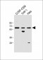 FCGR1B Antibody (C-term)